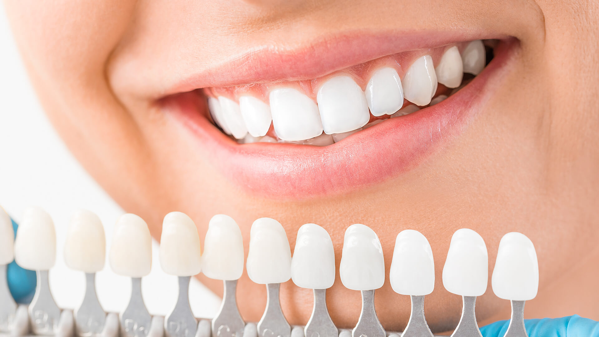 Laserterapia dentale